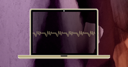 Our Proprietary Data Analysis Shows 17% Total NIH Grant $ Decline, 24% Genomics Grant $ Decline 2025 YTD