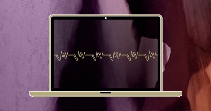 AI-Driven Drug Discovery, Development & the Outlook for Life Sciences Tools